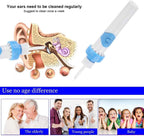 Earwax Removal Vacuum Cleaner,Electric, Comfortable Wax Suction Device Earwax Remover Vacuum Ear Cleaning Tool of All Ages_8_image