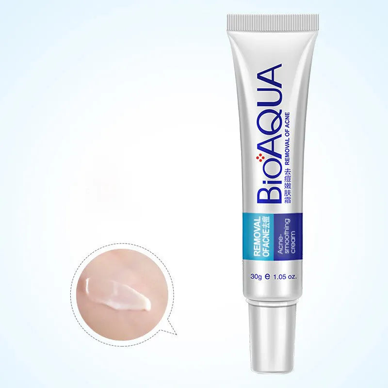 "BIOAQUA Anti Acne Cream Acne Scar Removal Cream BQY51278 "_3_image